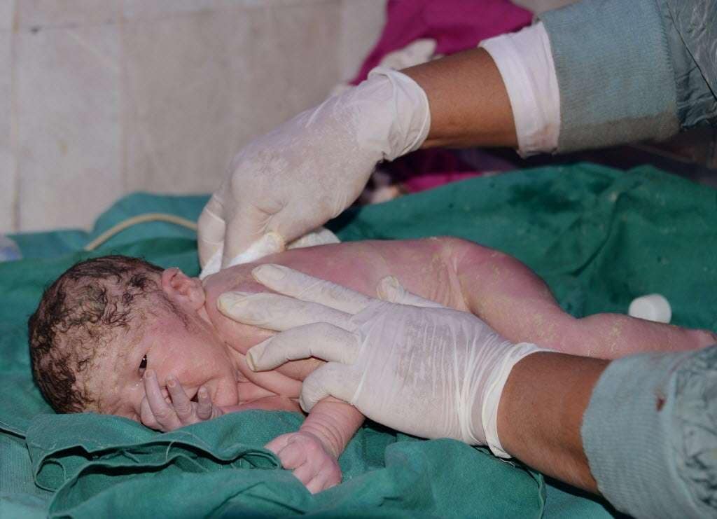 A unique baby born in Pakistan with two private parts Even the doctor