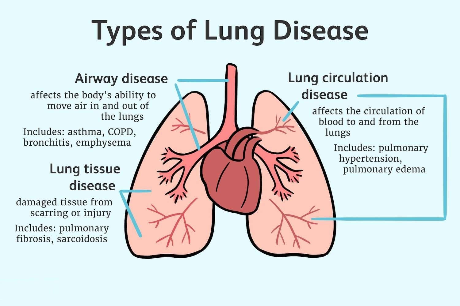 World Lung Day 2023 Lungs