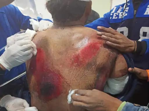rishabh pant car acident