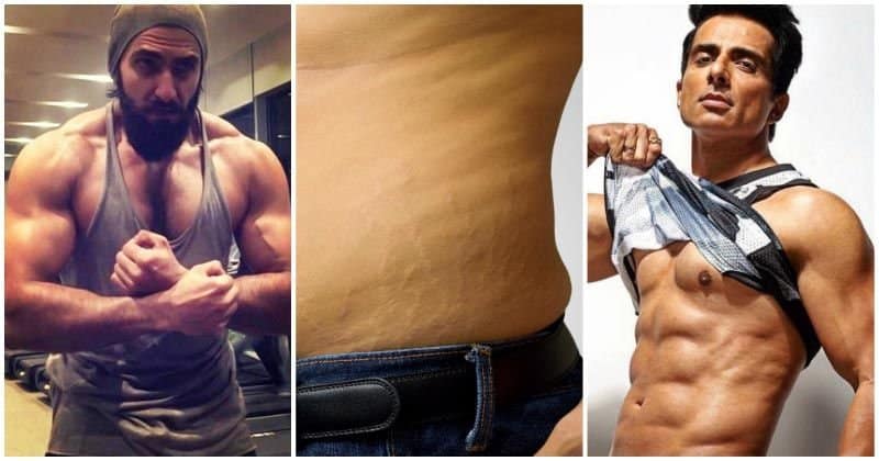 How To Remove Stretch Marks,Men Skin Care